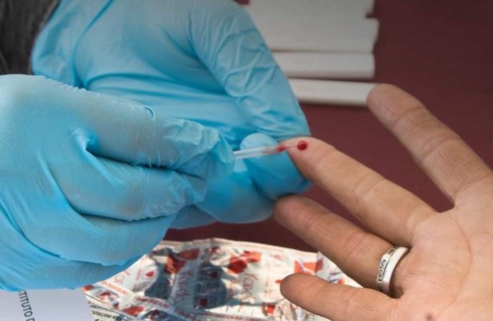 El VIH se puede prevenir en 72 horas