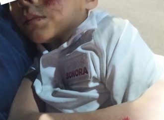 Niño de 6 años es atropellado; conductor se da a la fuga en Hermosillo