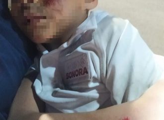 Conductora se da a la fuga tras atropellar a niño en Hermosillo