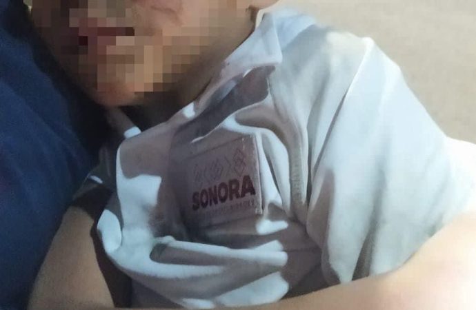 Conductora se da a la fuga tras atropellar a niño en Hermosillo