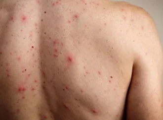 Jalisco impone uso obligatorio de cubrebocas en escuelas ante brote de sarampión