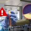 Casi 6 de cada 10 casos de dengue en Sonora presentaron signos de alarma; la disminución de plaquetas fue la más frecuente