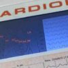 Cruz Roja Hermosillo mantiene en promoción el electrocardiograma